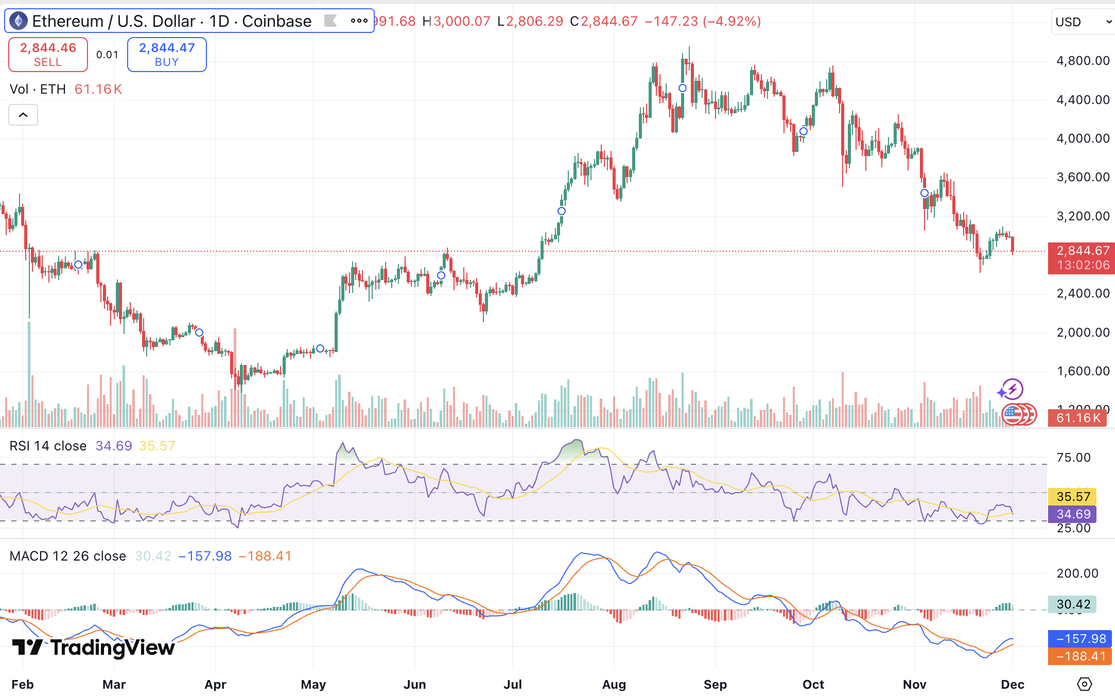 오늘 비트코인 하락 이유: BTC 급락, ETH·XRP까지 동반 약세